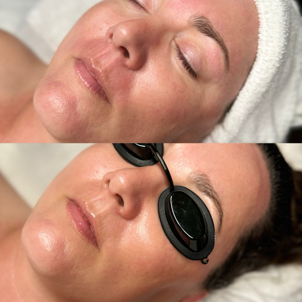 Berry Brightening Facial