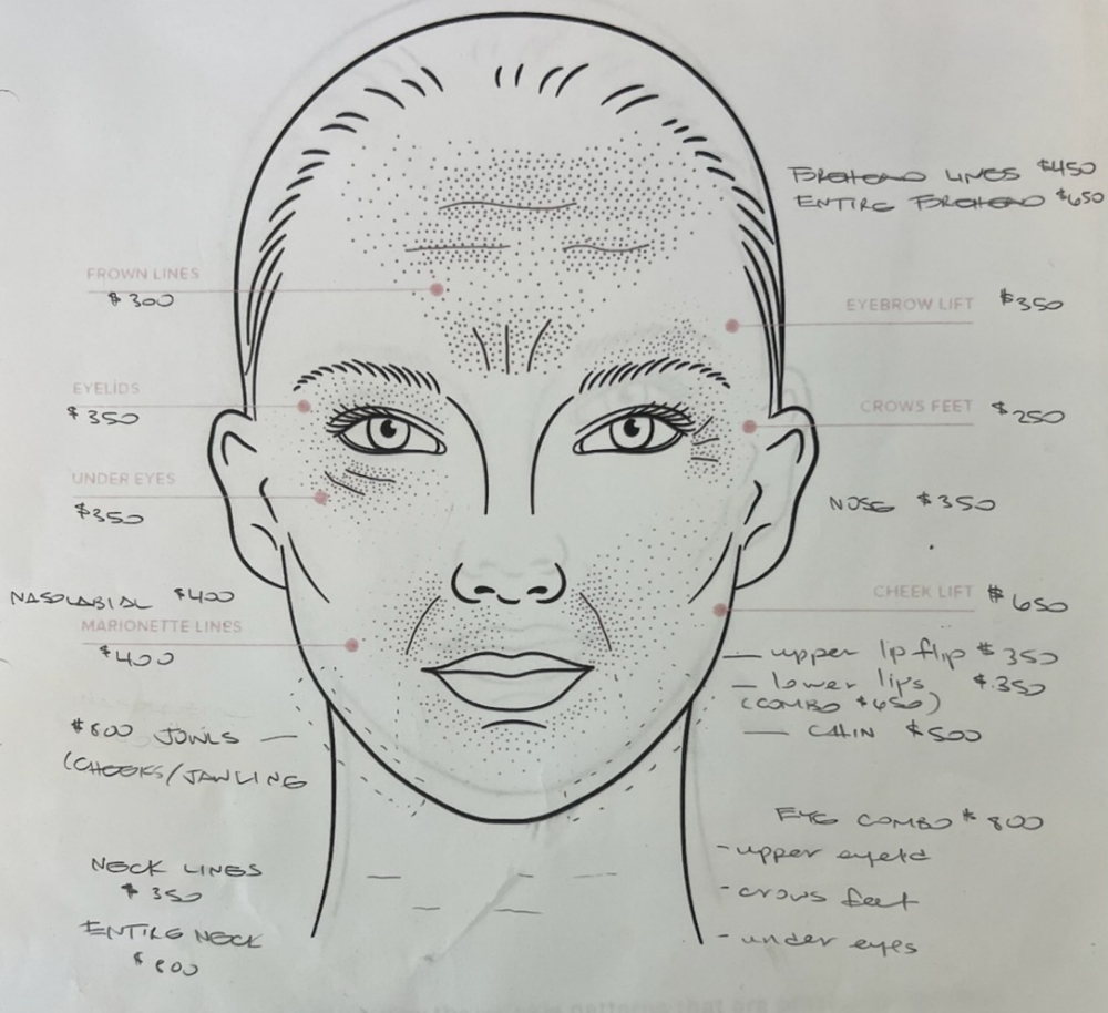 Chin Tightening