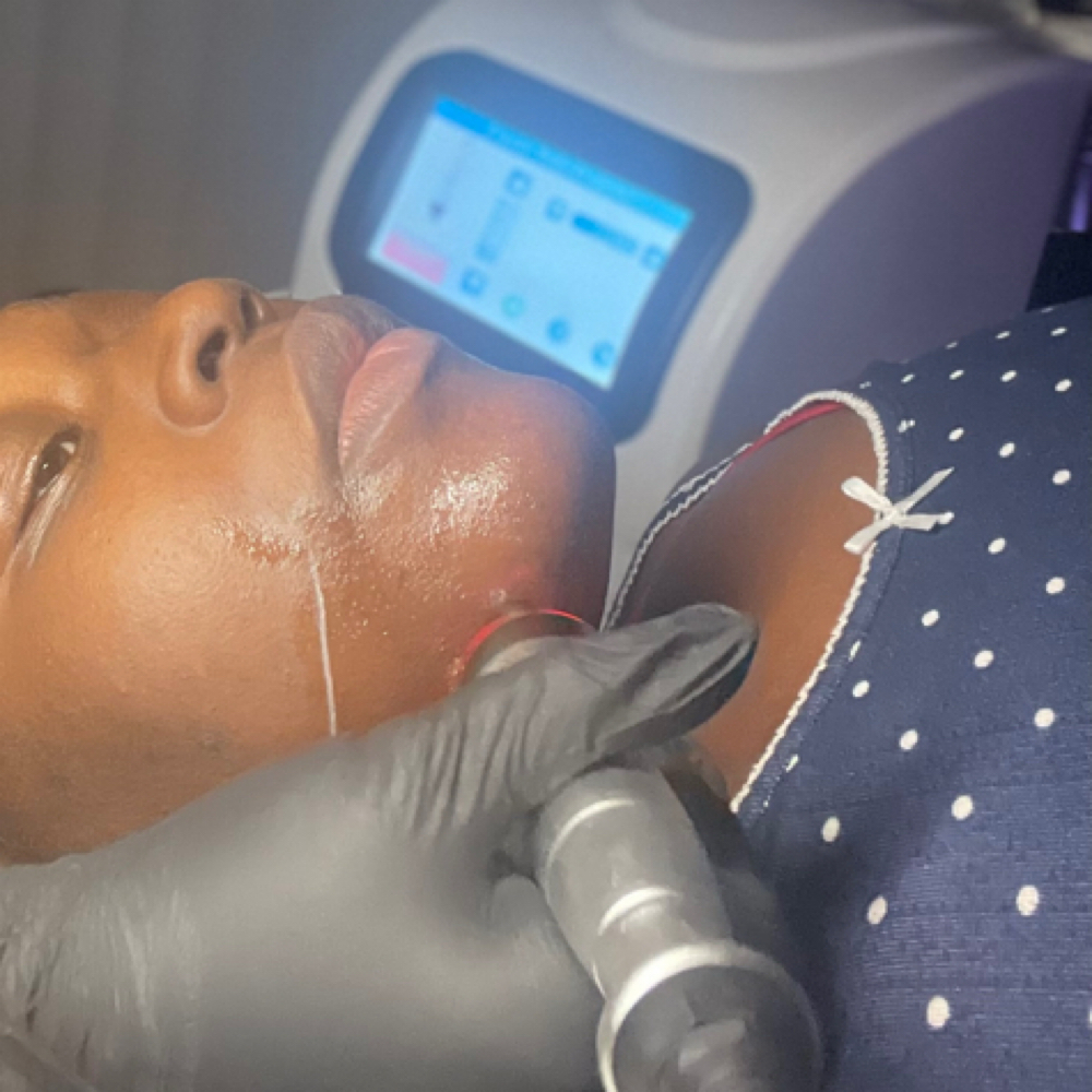 Double Chin at SapphireHatchet Esthetics