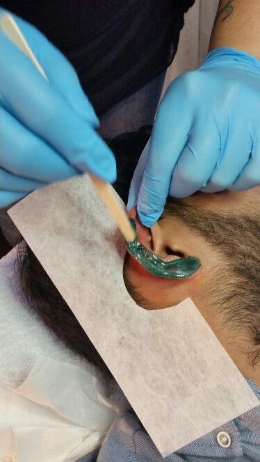 Ears Wax | Hair Removal