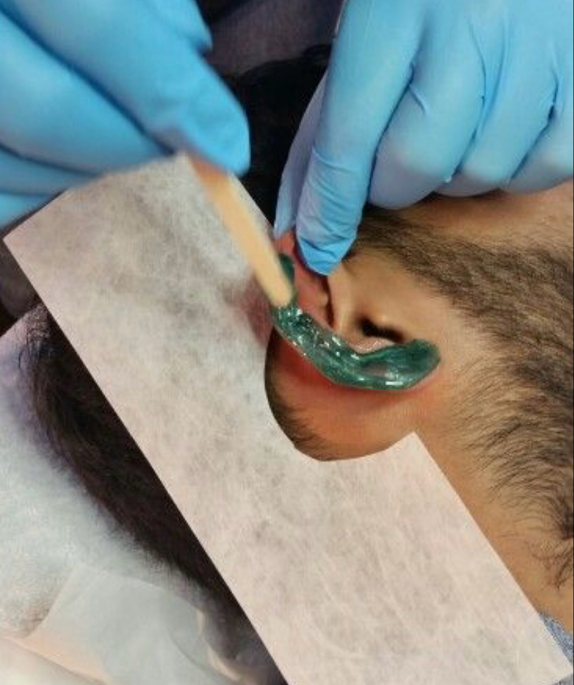 Ear Hair removal
