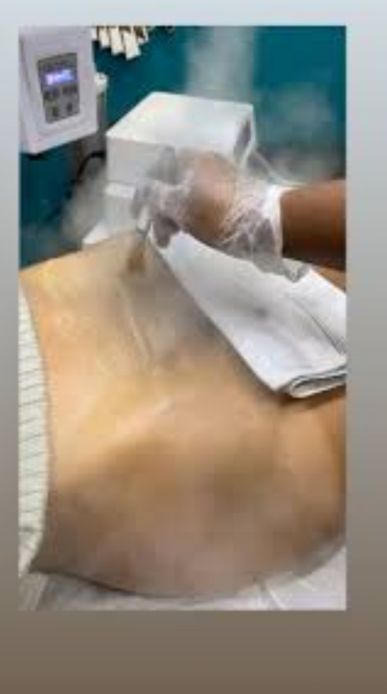 Vagi Facial
