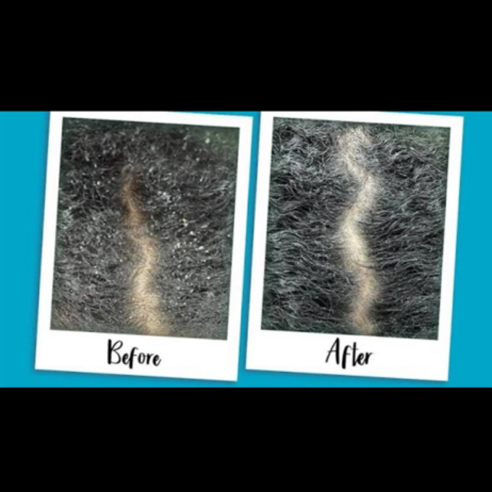 Flaky Scalp Detox at Kia Beauty in Columbus, GA