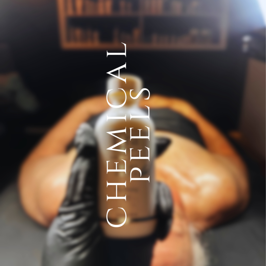 Revitalizing Lower Leg Peel at R&R Aesthetics - Prescott, Arizona in Prescott, AZ