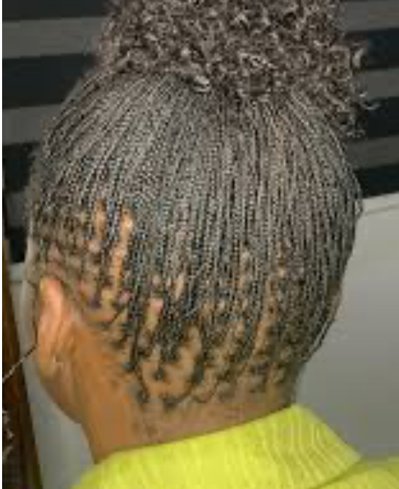 Micro Locs