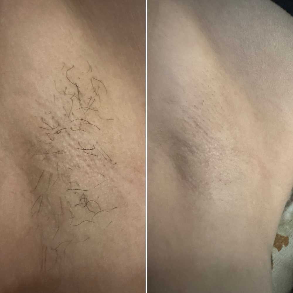 Under arm limited time offer at Sexymakeupnailsbeauty in Temecula, CA