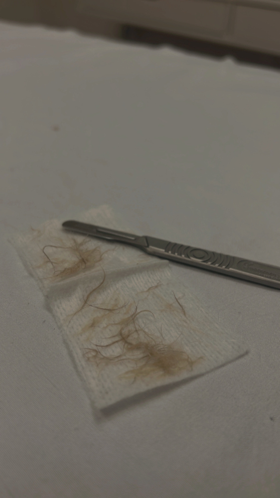 The Dermaplaning Facial
