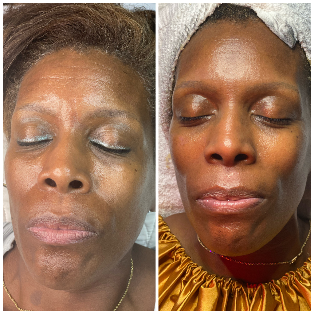Snatched & Smooth Facial (Lift)
