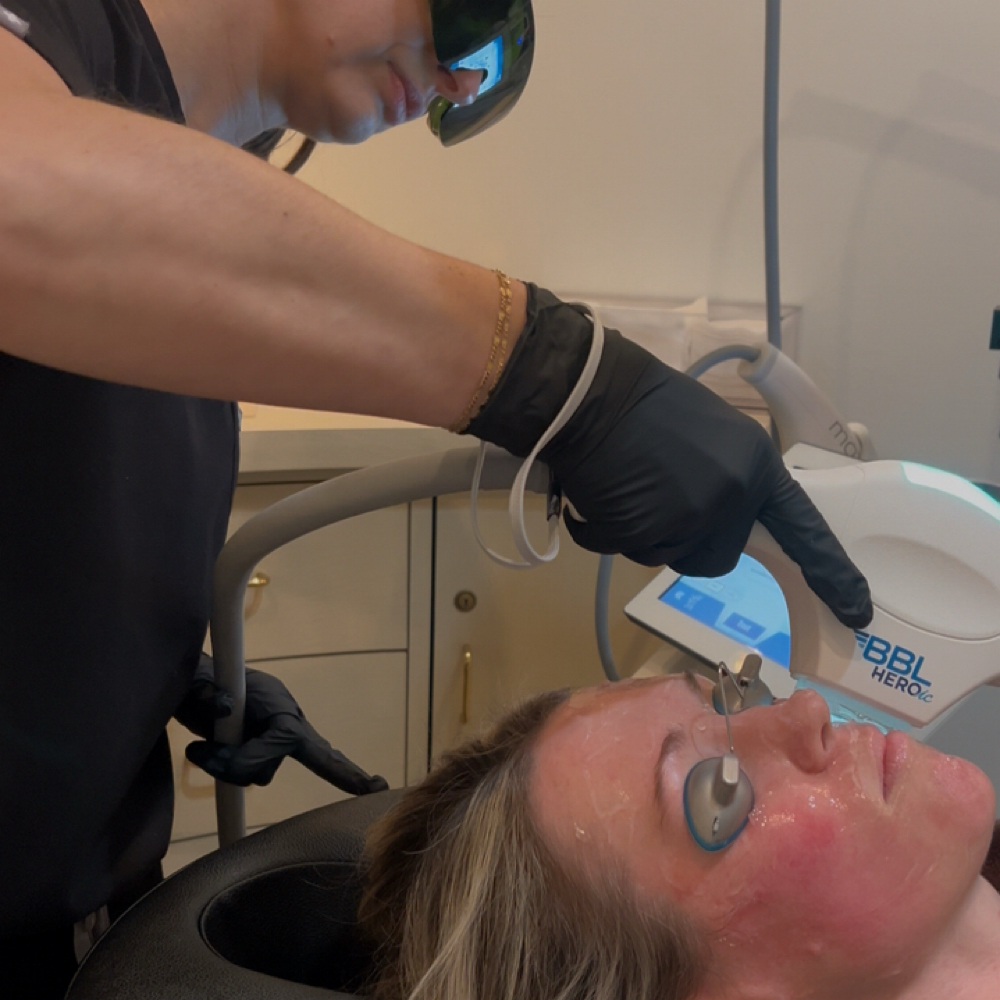 BBL / MOXI Combo at Your Body at Timeless Skin & Aesthetics in Bloomfield Hills, MI