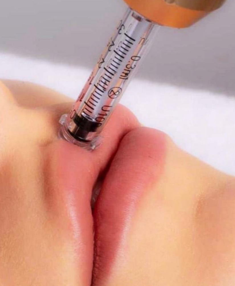 Needleless Filler