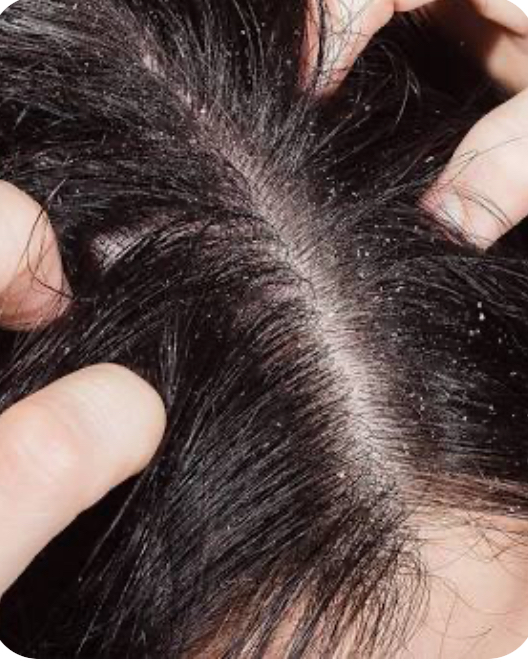 Hydrating Scalp Treatment