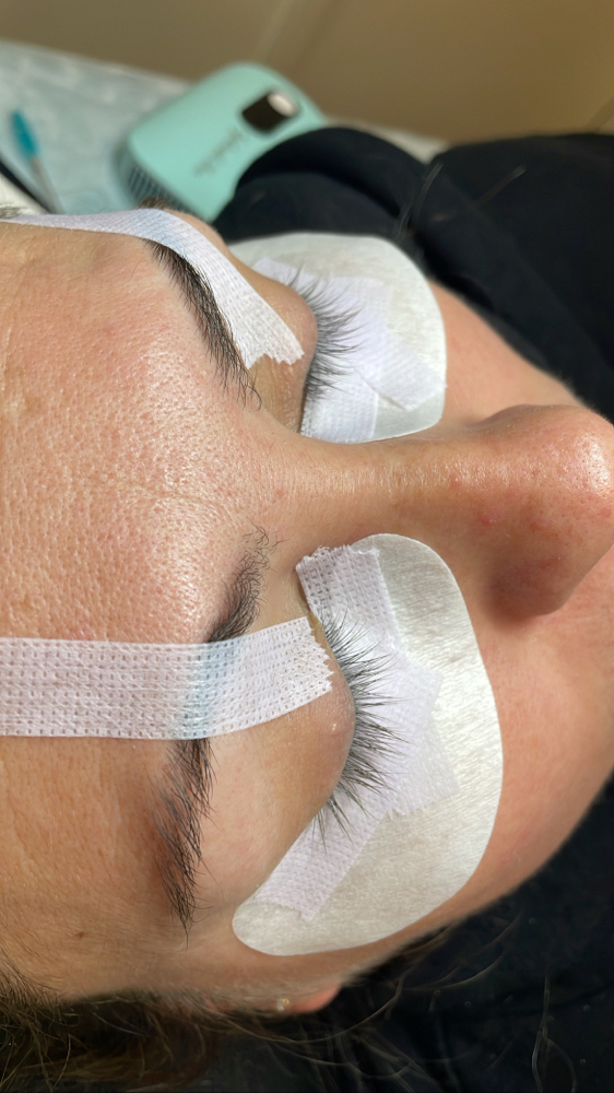 Eyelash Removal