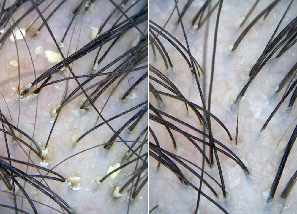 Sage It-Relaxing Scalp Cleansing