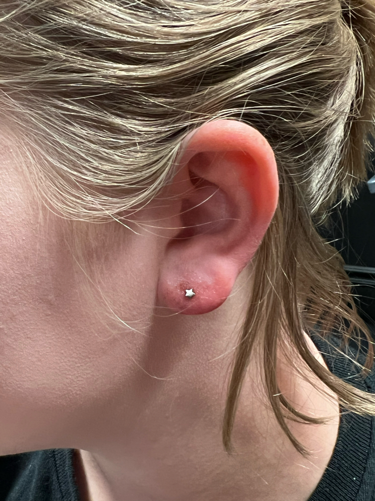 Lobe