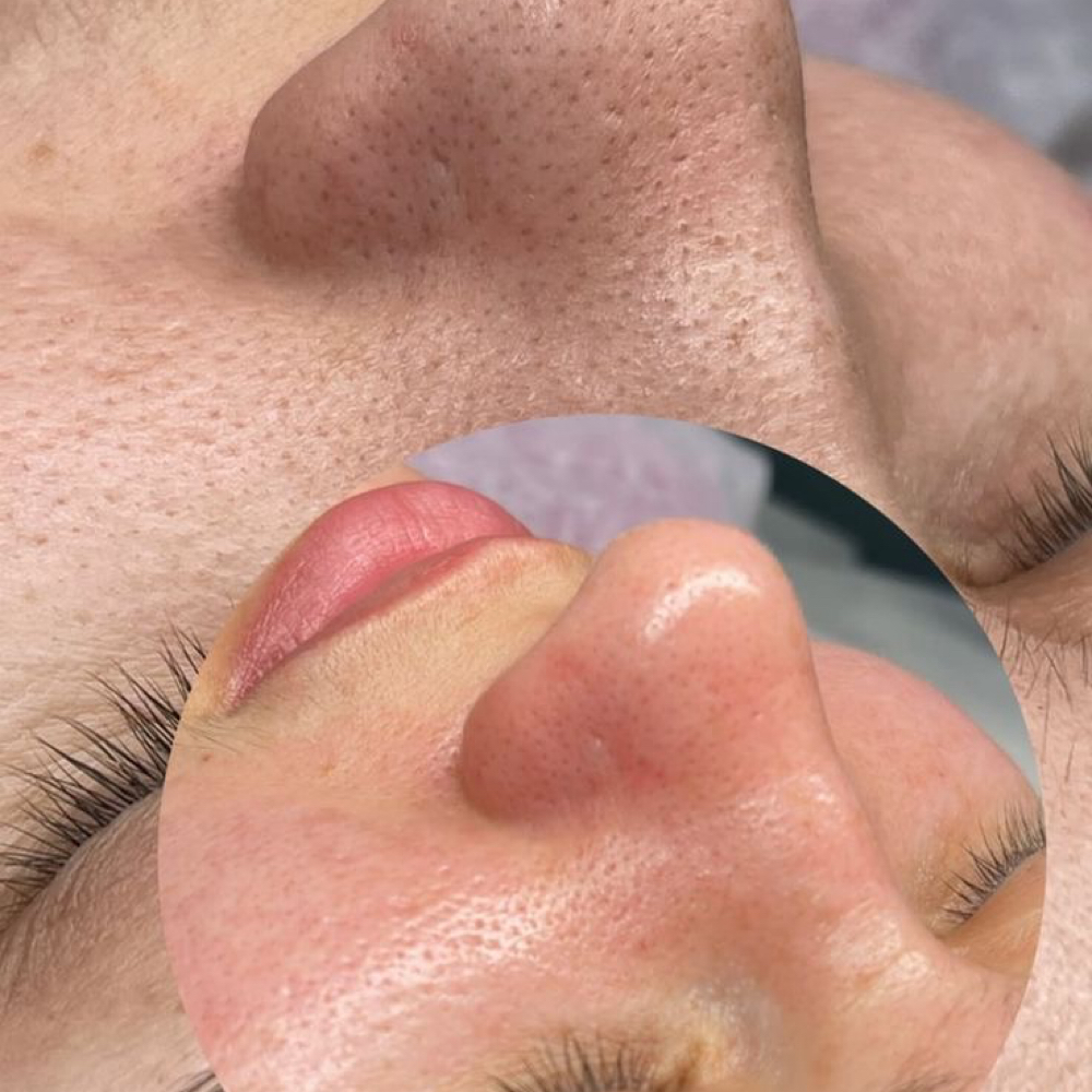 Pore Purifying Facial at Bella Donna Esthetics in Beaufort, SC