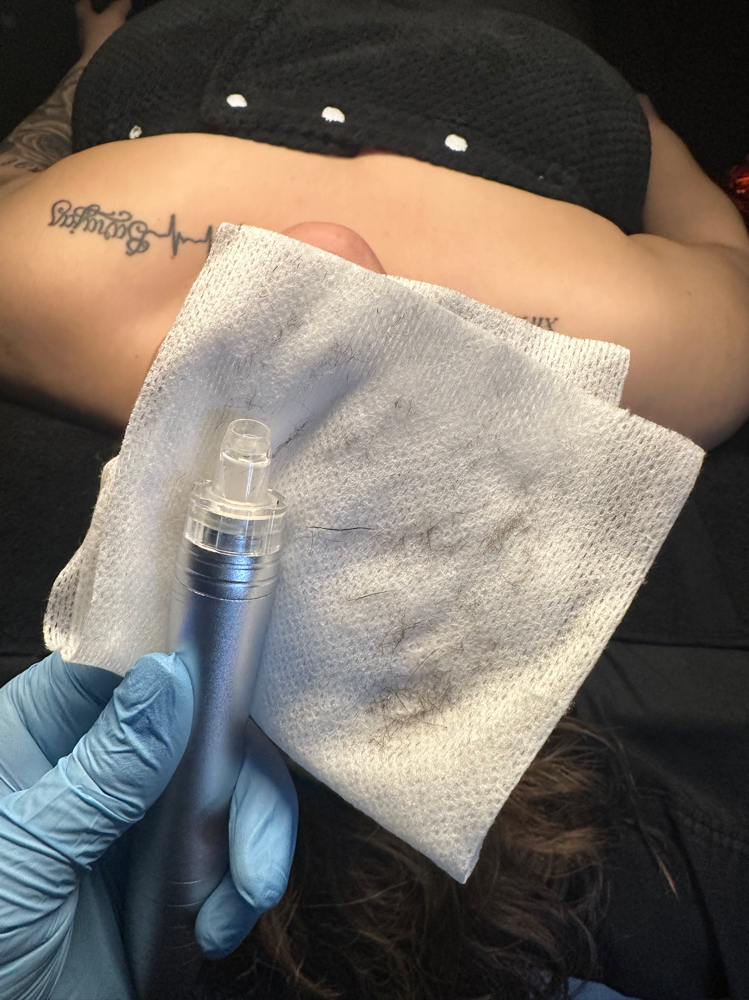 Alchemy + Elixir (Hydroderm+Derma)