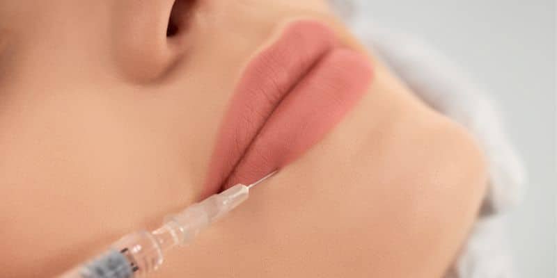 Lip Filler 1/2 Syringe