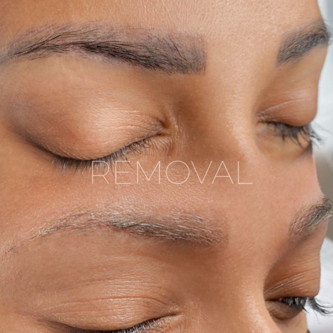 LIQUID REMOVAL OF PERMANENT MAKEUP at Alona Beauty Studio European Permanent Makeup & Nail Art in Foley, AL
