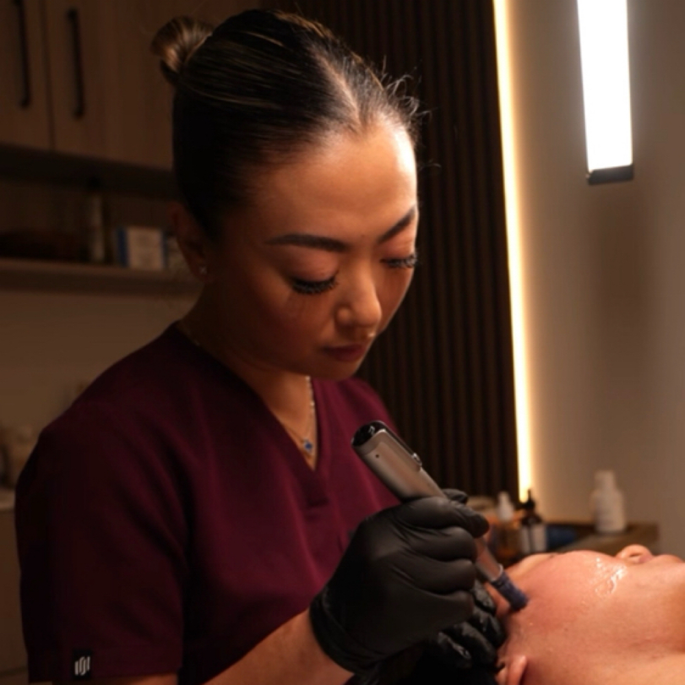 Microneedling With Dr. Pen at Nuskyn Studio in Dania, FL
