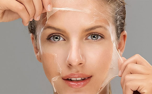 Chemical Peel