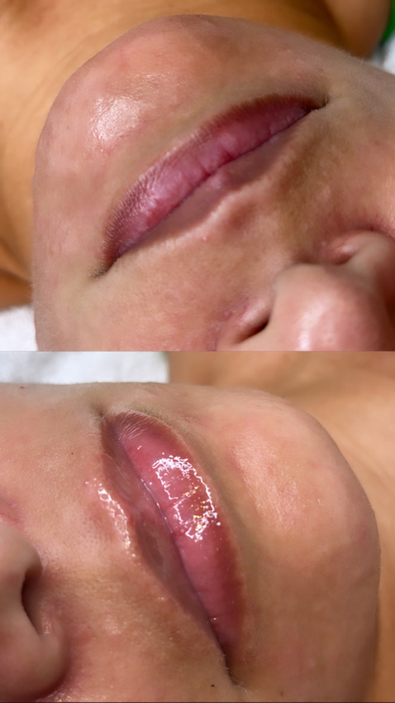 Hidragloss Lip
