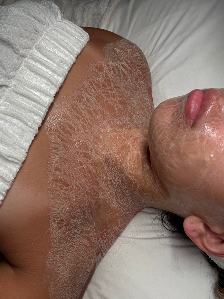 Luxe Lift Facial (Anti-Aging) at Nikki Lee Esthetics in Pearland, TX