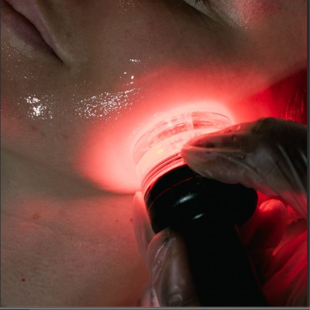 MICROCURRENT LIFT ADD-ON at SKIN & TONIC Esthetics in Sarasota, FL