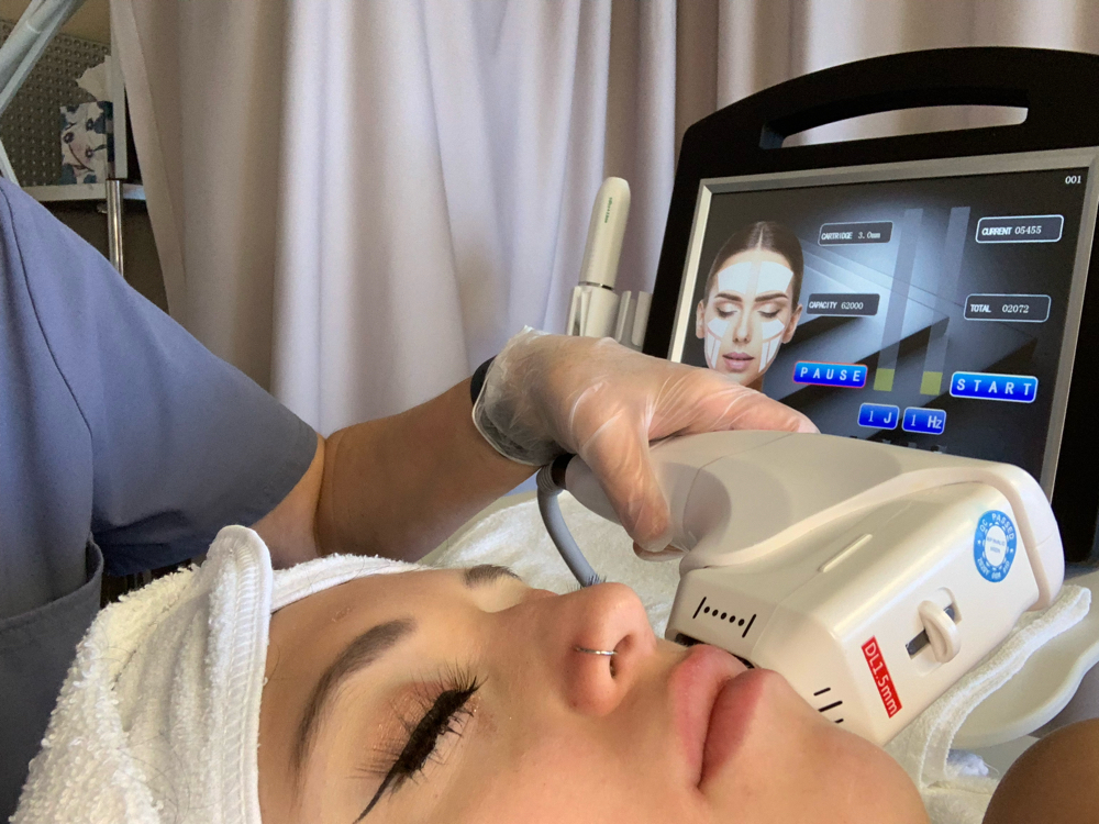 HIFU ULTHERAPY FACE OR NECK-LIFT