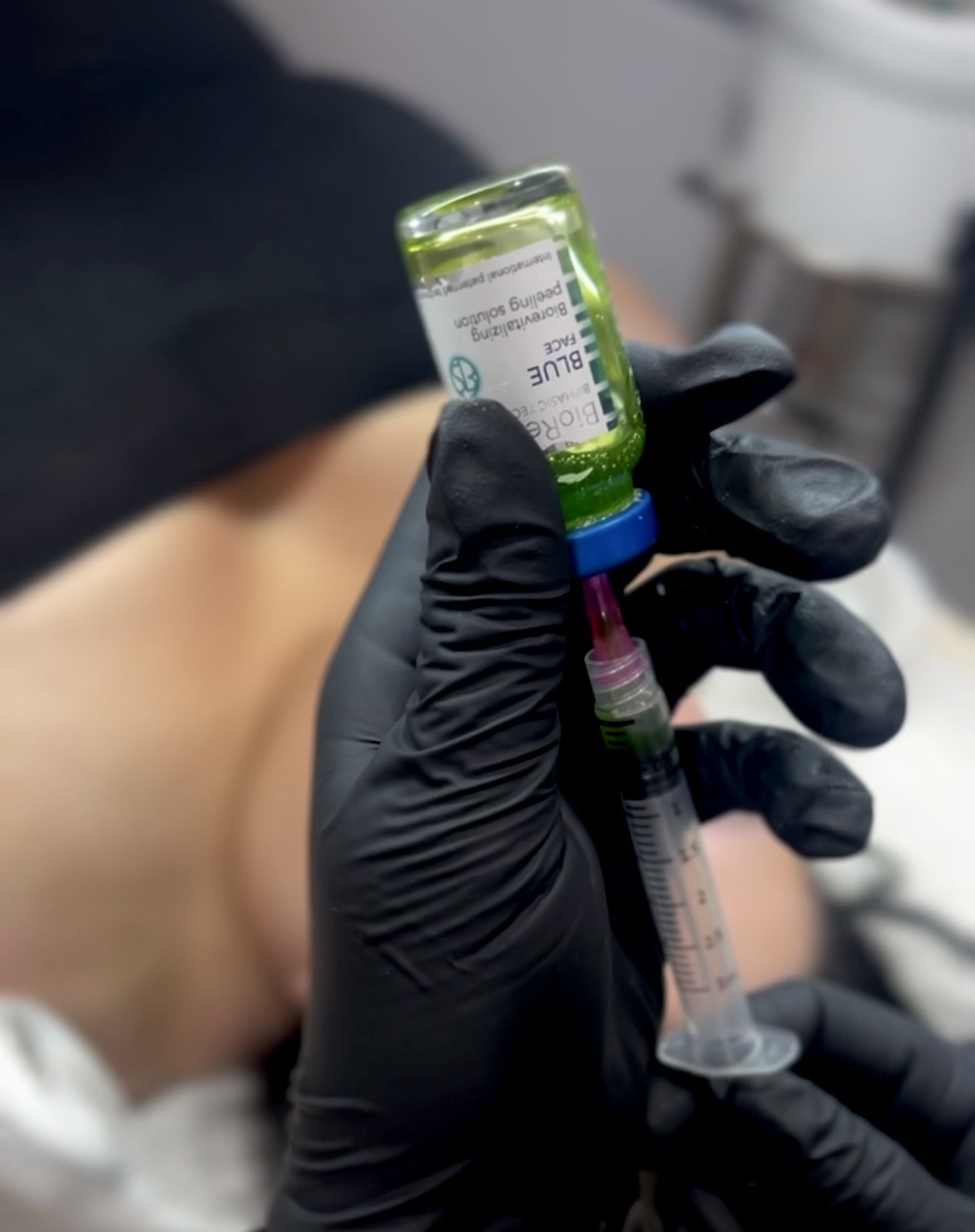 BioRePeel (Chemical Peel)