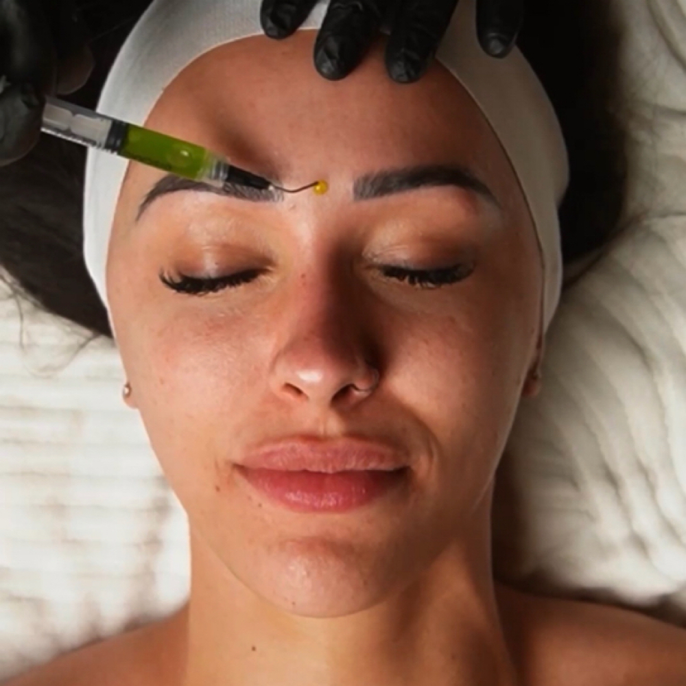 BioRePeel ADD ON TO SKINPEN/Facial at Skin Aesthetics Studio in East Bernard, TX