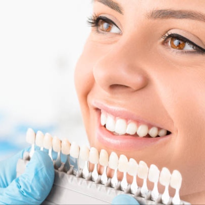 Teeth Whitening (Returning Clients) at Rise Beauty Studio in Forest Grove, OR