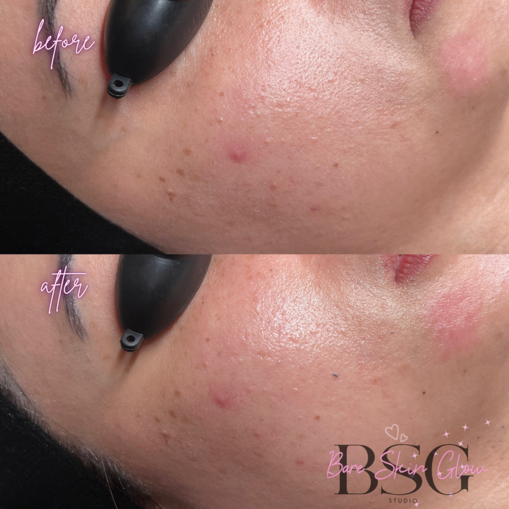 Hydrating Facial