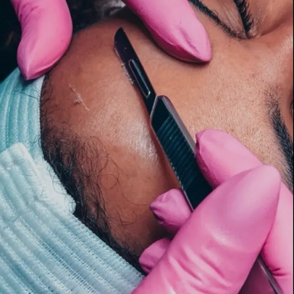 Dermapane With Facial at Skin Is In Esthetics in Sarasota, FL