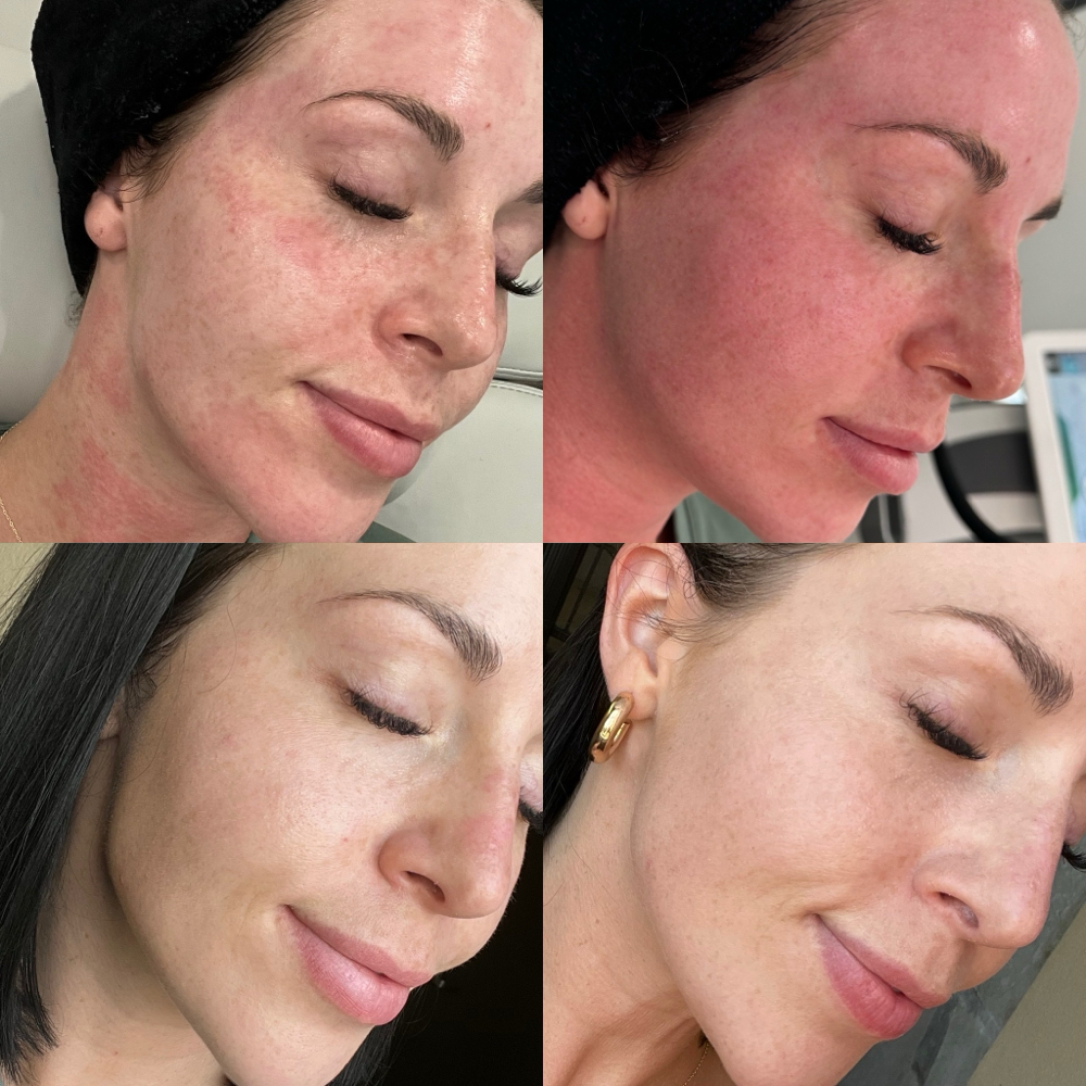 Holiday Glow Promotion
