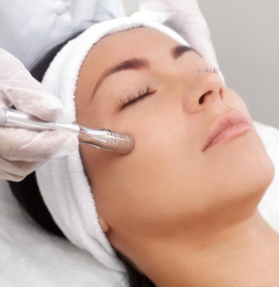Add On Microdermabrasion