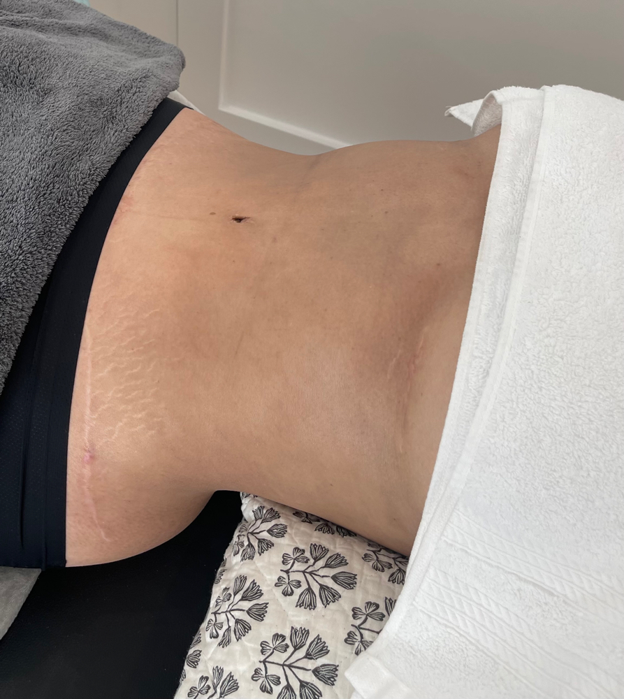 Post-Surgical Sculpt: in Your Space at Soul Science in Dallas, TX