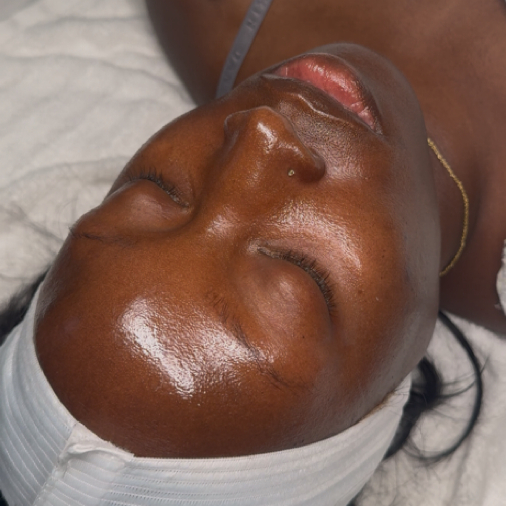 Chemical Peels at Trendiskin Esthetics in Baton Rouge, LA
