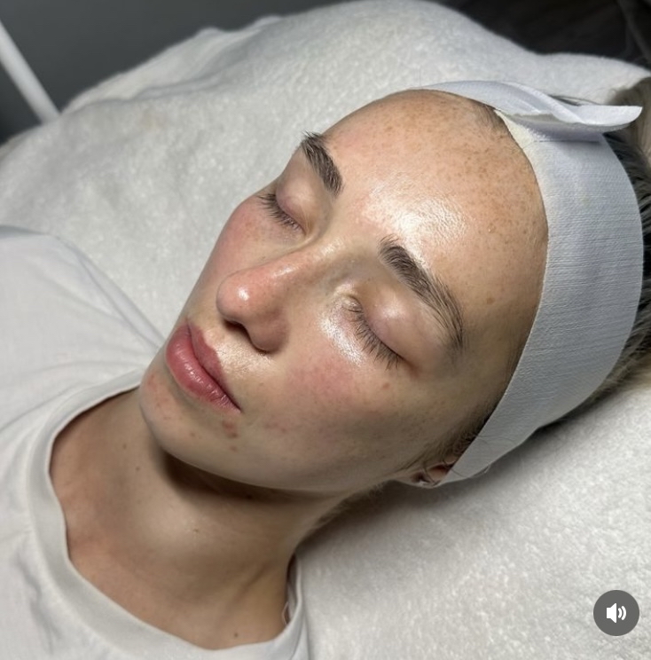 Glisten Custom Facial