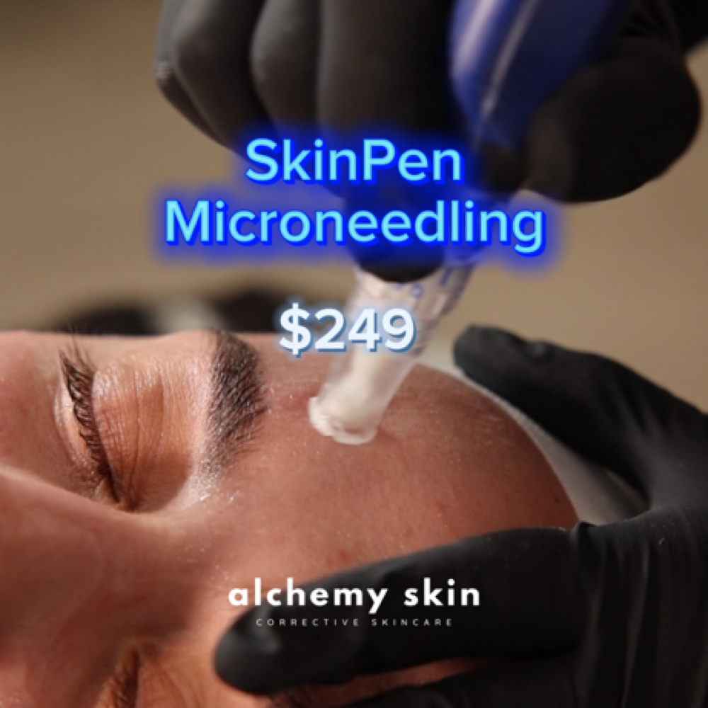 $249 Intro SkinPen at Alchemy Skin in Lewisville, TX