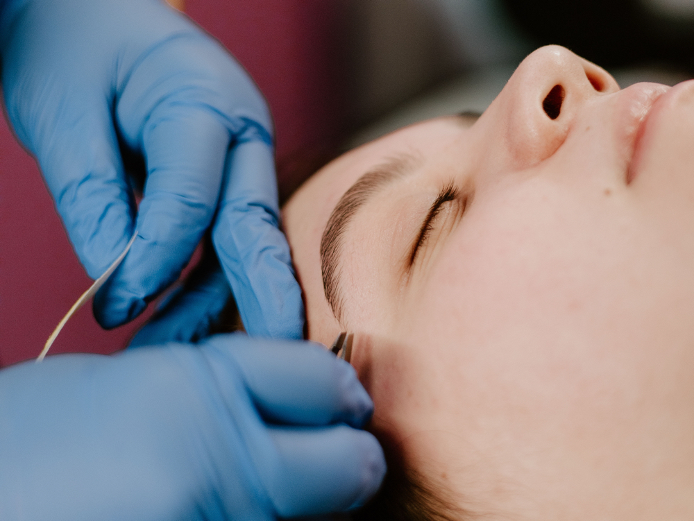 Brow Tweeze at Star Esthetics in Columbus, OH