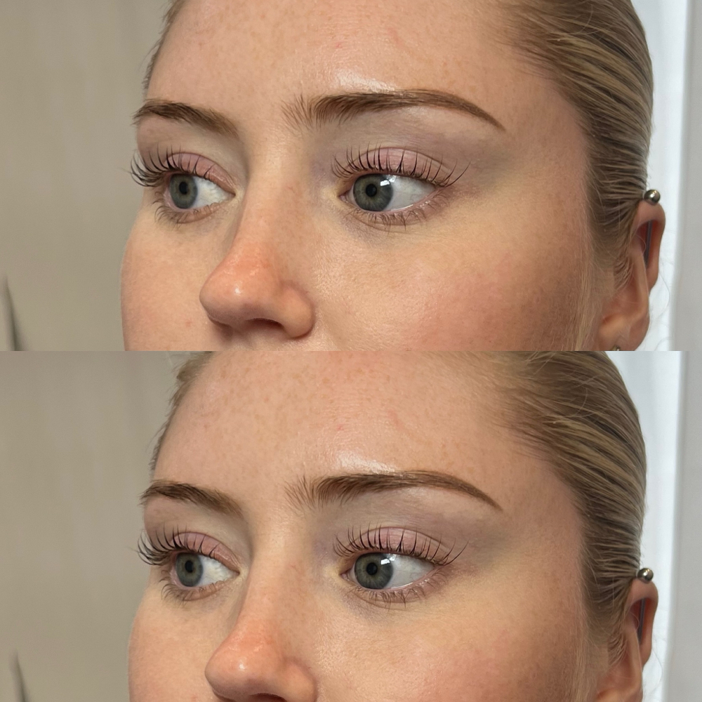 Lash Lift