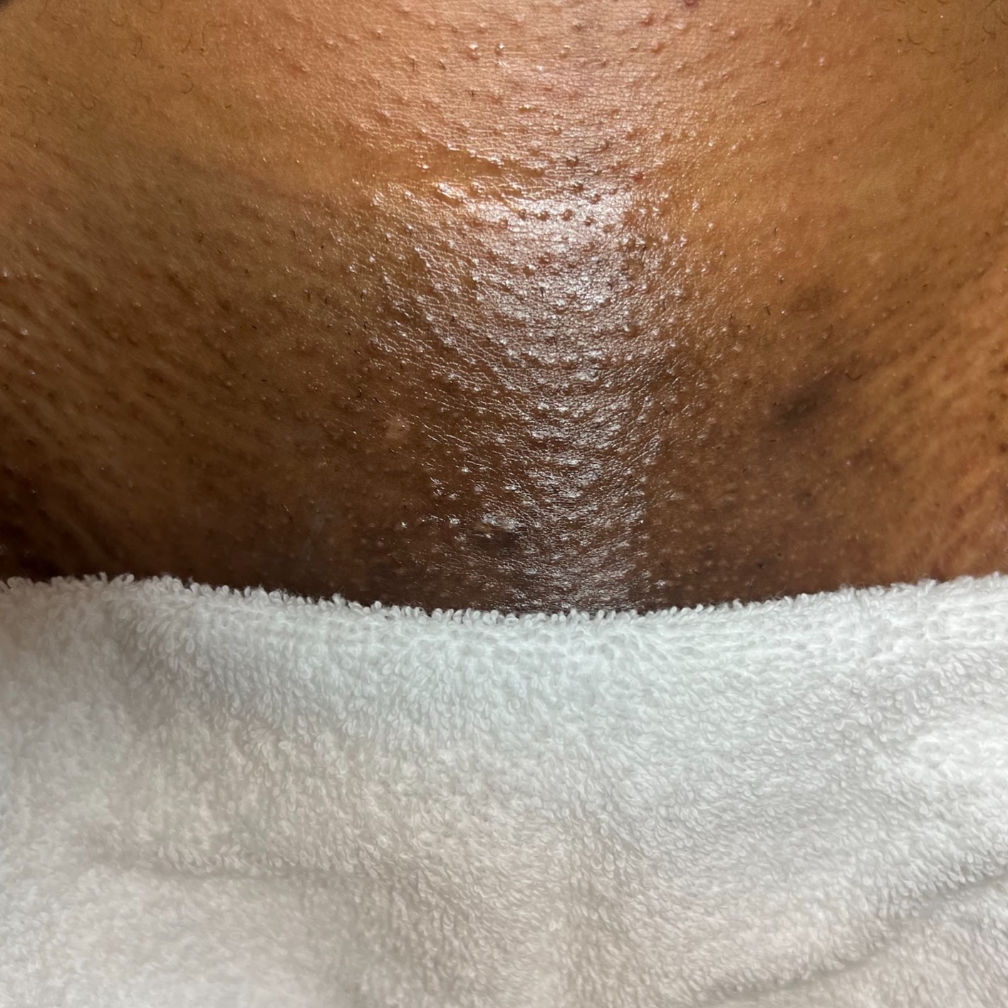 First Time Brazilian at Carolina Grout Esthetics in Watford City, ND