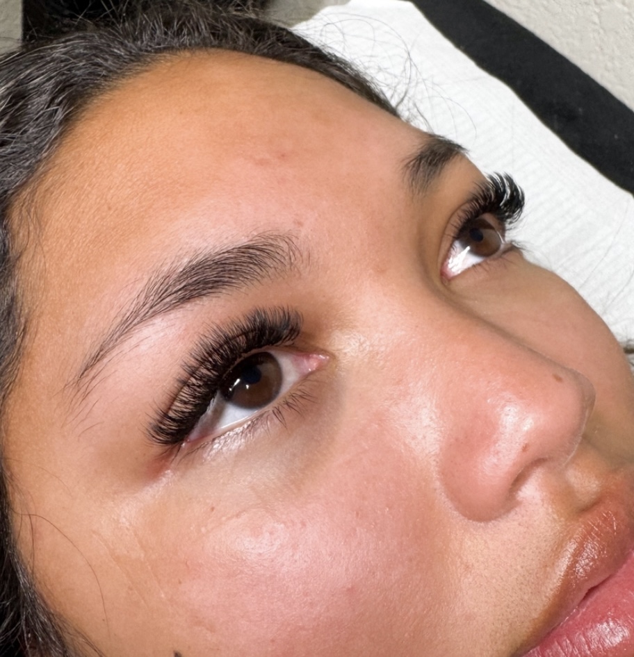 Volume-3 Week Fills at Bryten Gilliam Aesthetics in Brock, TX