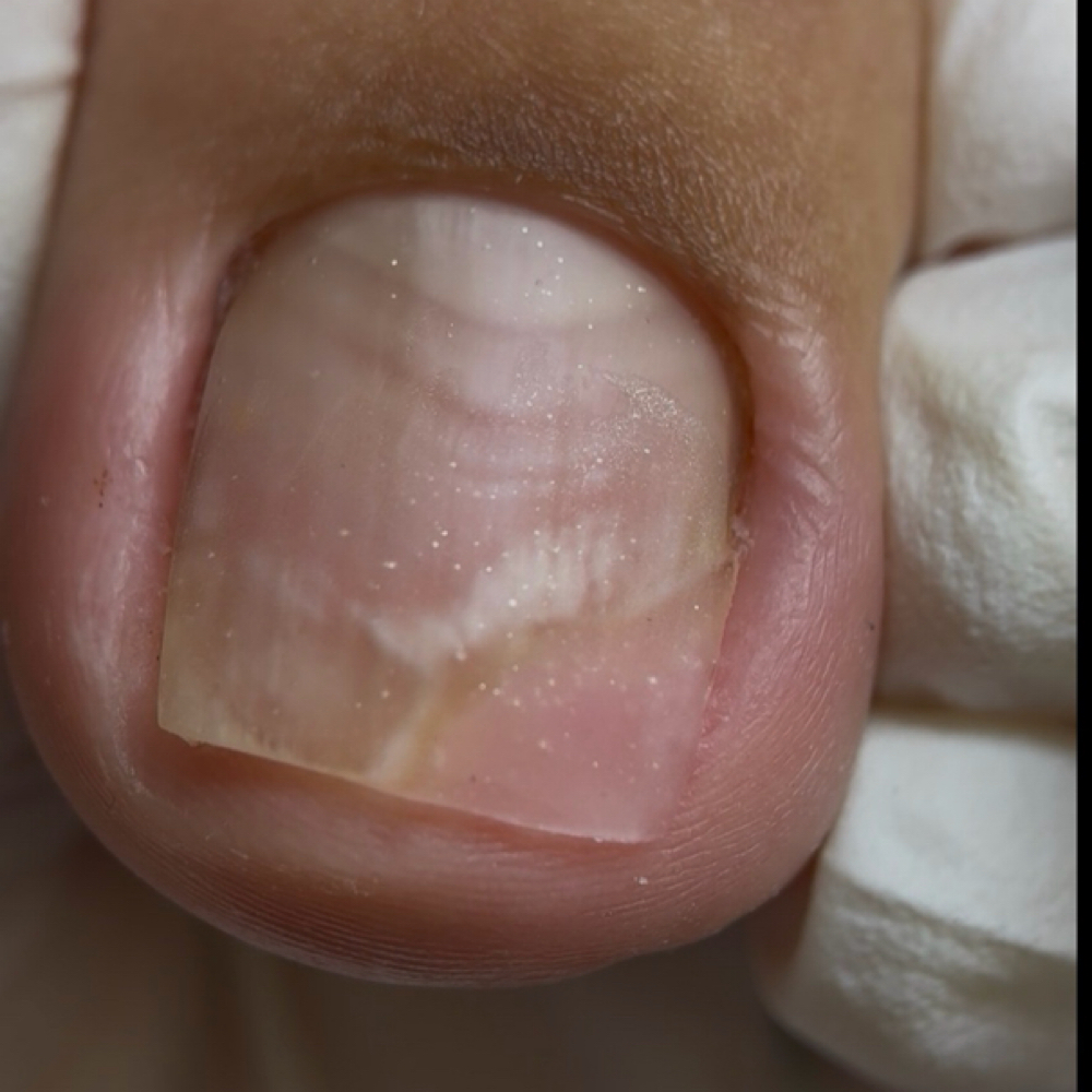 Nano flex Manos Reconstrucion at Ambar Nails Art Studio in Orlando, FL