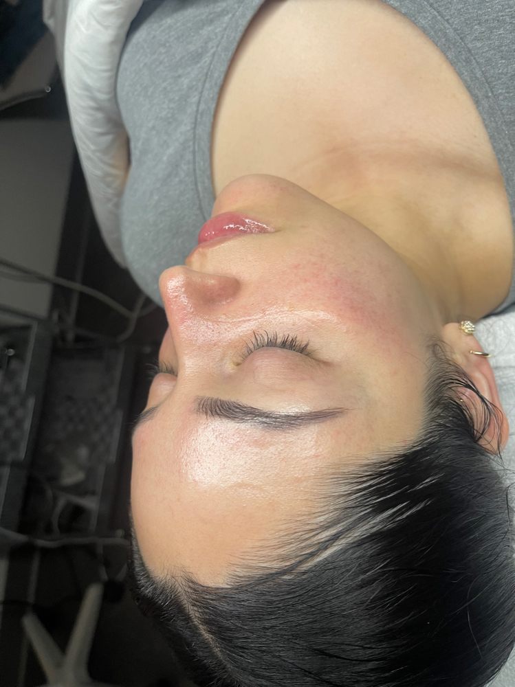 Luminous Signature Facial