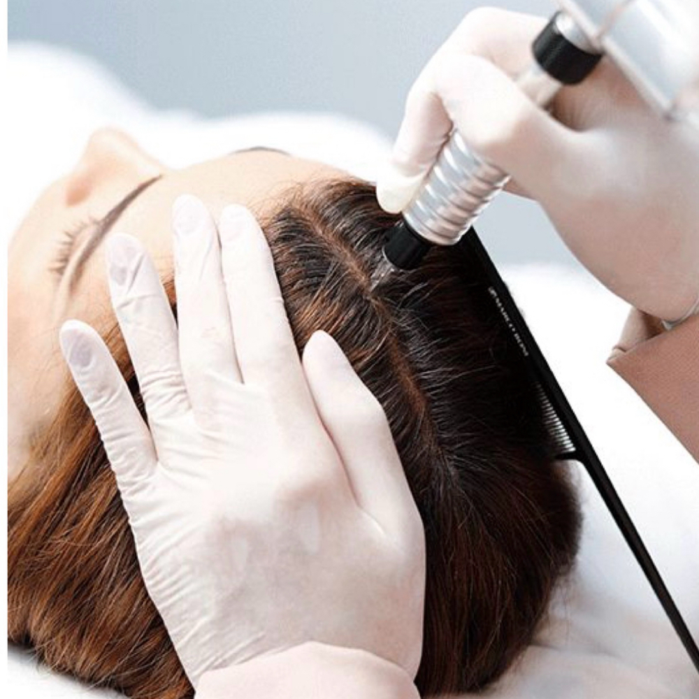 Pigment Scalp Implantation at Everlasting Beauty By Natachia in Farmingdale, NJ