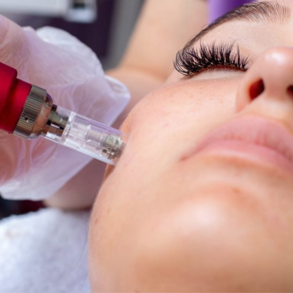 Microneedle + LED Red Light at Brittney Murphy’s Skincare in Windsor, CO