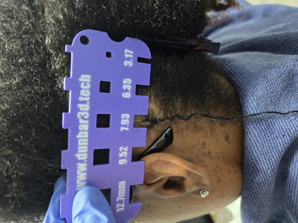 Microlocs Consultation