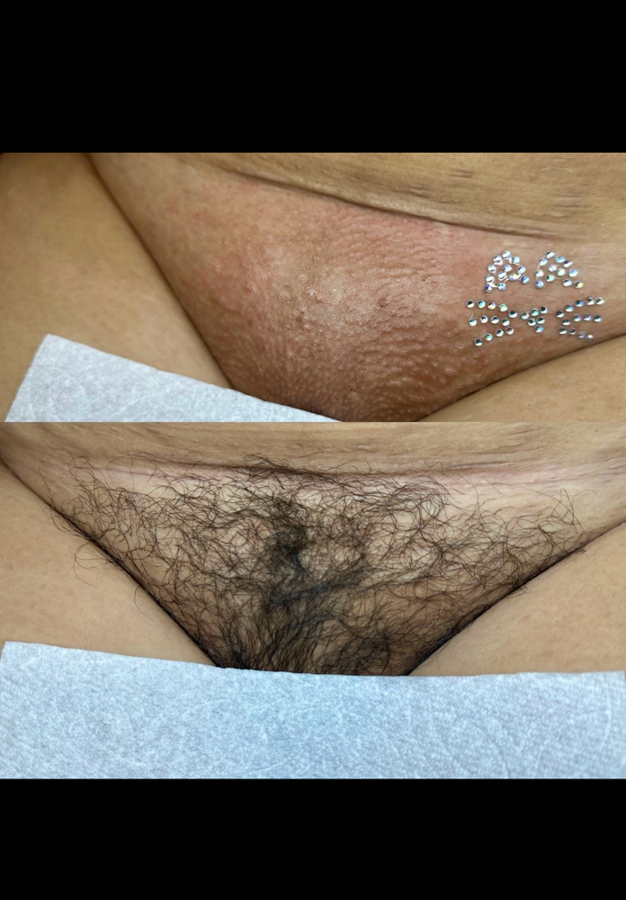 Brazilian Wax at Justt a tad esthetics in Fresno, CA