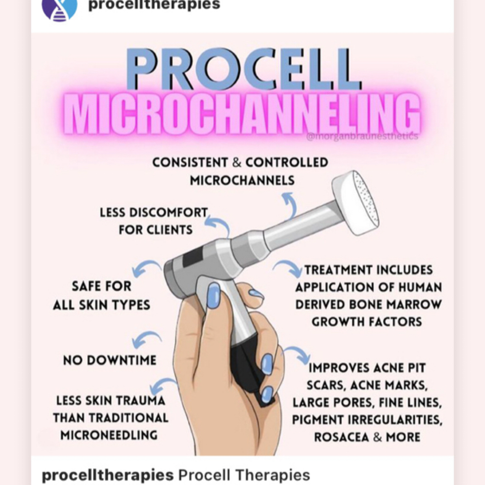 Micro channel with hgf at Canvas Love in Vancouver, WA